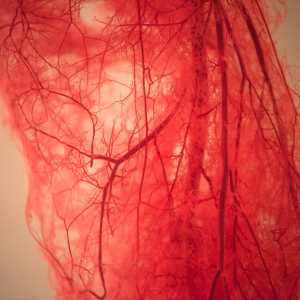 Casa di Cura Barbantini<br>L’insufficienza venosa e le sue complicanze